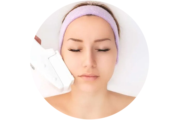 IPL Photofacial