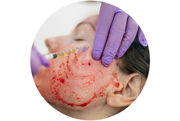 Vampire PRP Facial