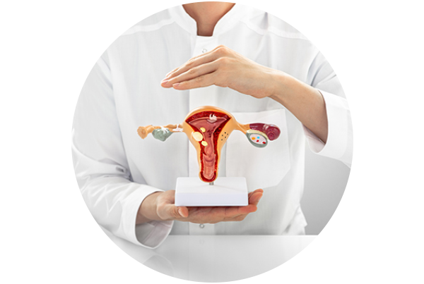 Uterine Fibroids