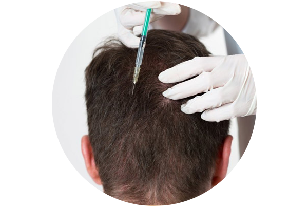 Hair Mesotherapy